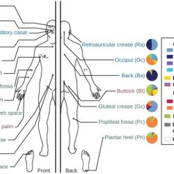 Normal biota includes each of the following except